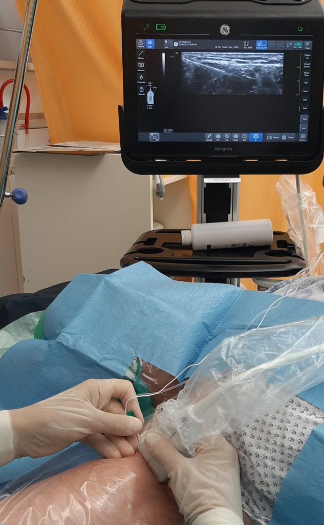 Basic Ultrasound in Anesthesiology