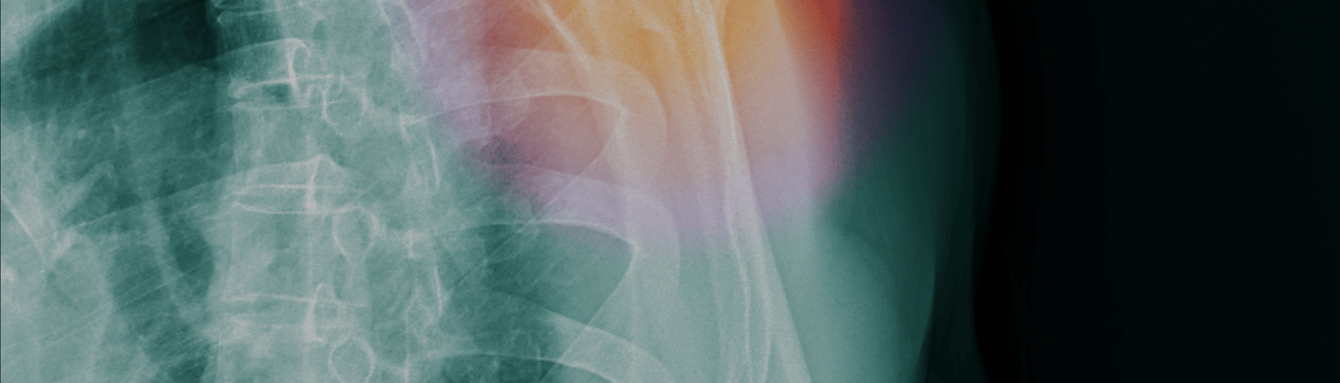 Torsten-Diekhoff-banner